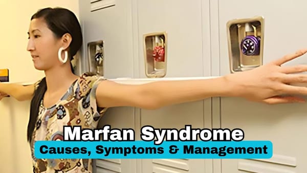 Marfan Syndrome: Causes, Symptoms, and Management
